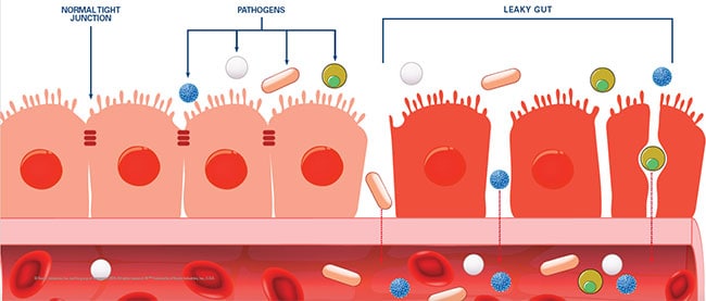 intestino felice e disbiosi