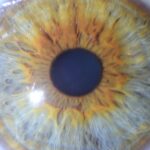 Iridologia in Naturopatia